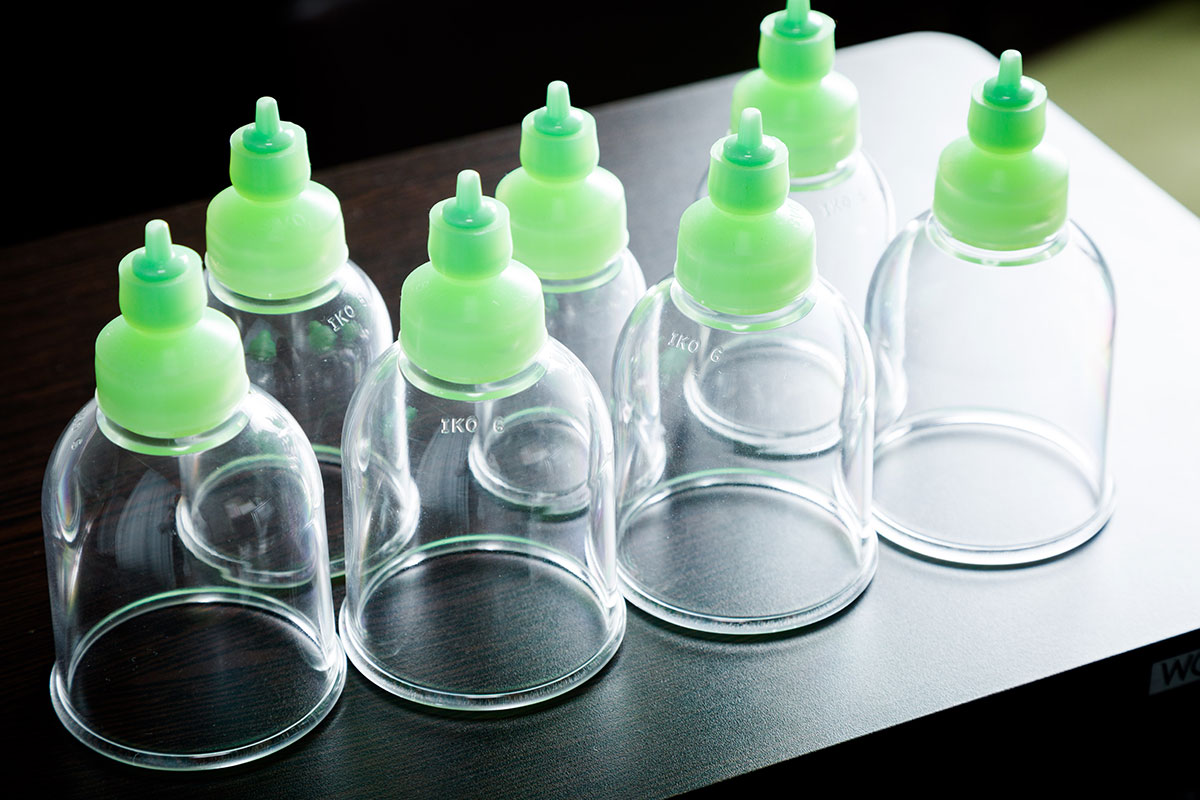 吸玉（カッピング）